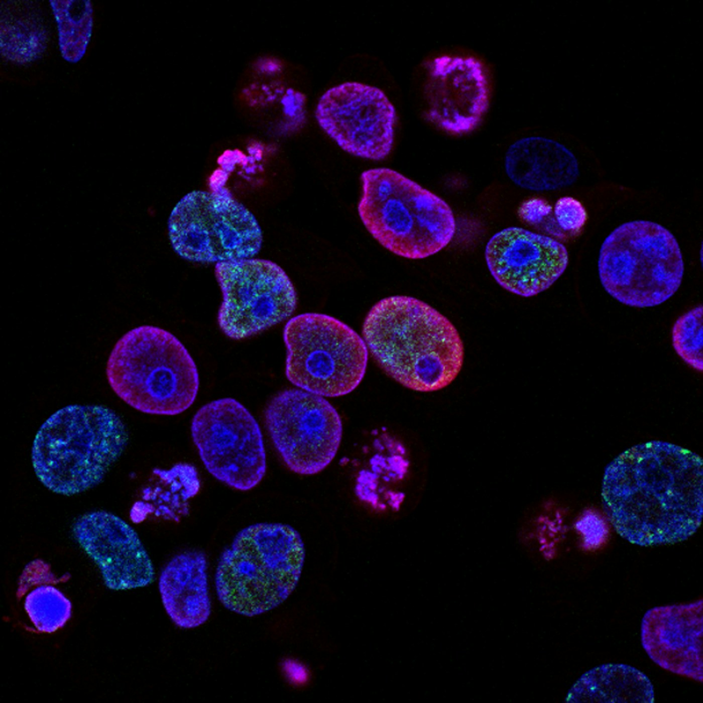 Imagen microscópica de células iluminadas en un entorno de investigación biomédica